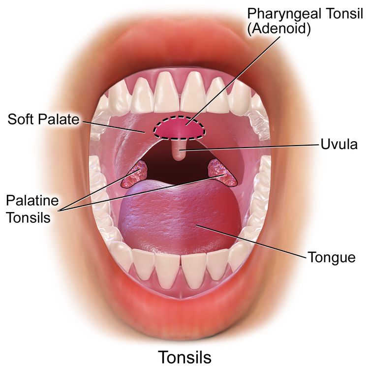 Removing Tonsils Pros and Cons